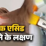 शरीर में नजर आ रहे ये लक्षण न करें नजरअंदाज, हो सकते हैं यूरिक एसिड बढ़ने के संकेत; कैसे करें कंट्रोल?