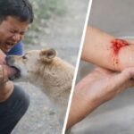 कुत्ता काटने के कितने घंटे के भीतर इंजेक्शन लगवाना है जरूरी? लापरवाही पड़ सकती है भारी, जानें एक्सपर्ट की राय…